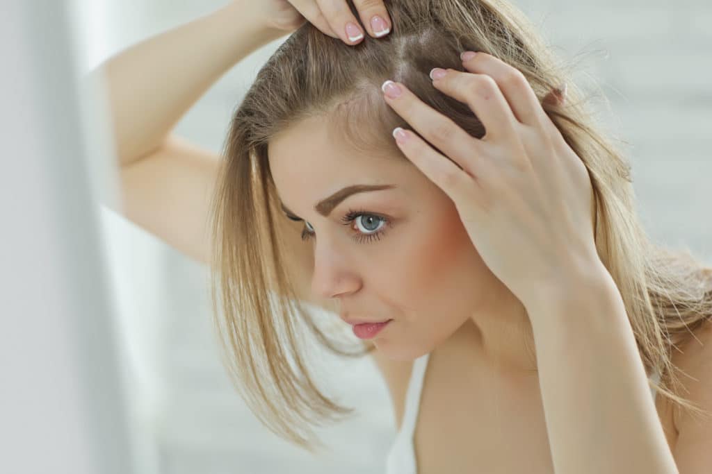 Mulher olhando no espelho enquanto mexe em seu couro cabeludo preocupada com queda de cabelo causada por Alopecia Areata
